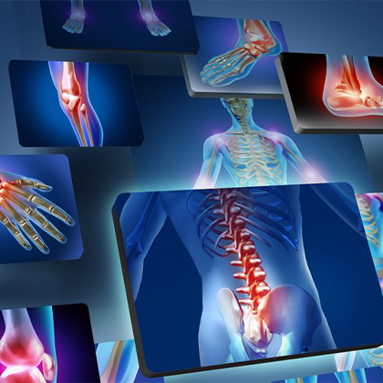 Pain Management